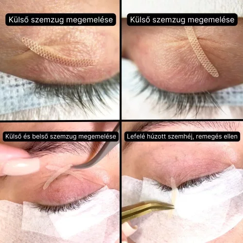 Szemhéj emelő szalag